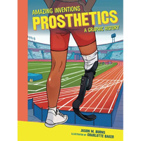 Prosthetics: A Graphic History - Paperback