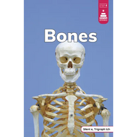 Bones - Paperback