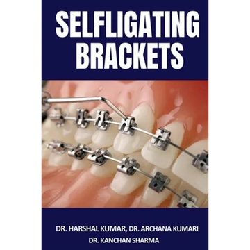 Selfligating Brackets - Paperback
