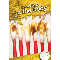 Gross Stuff in the Body - Library Binding