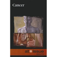Cancer - Paperback