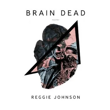 Brain Dead - Paperback