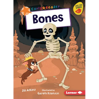 Bones - Paperback