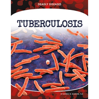 Tuberculosis - Library Binding