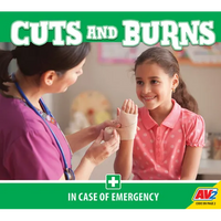 Cuts and Burns - Library Binding