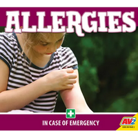 Allergies - Library Binding